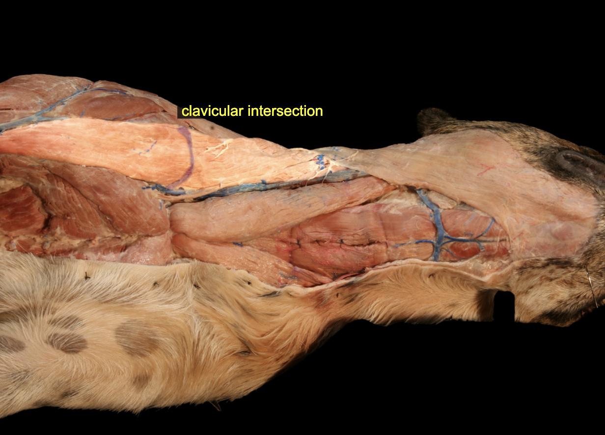 <p>Brachiocephalicus m. has a clavicular intersection (tendon), the connective tissue remnant of the clavicle between the two sections.</p>