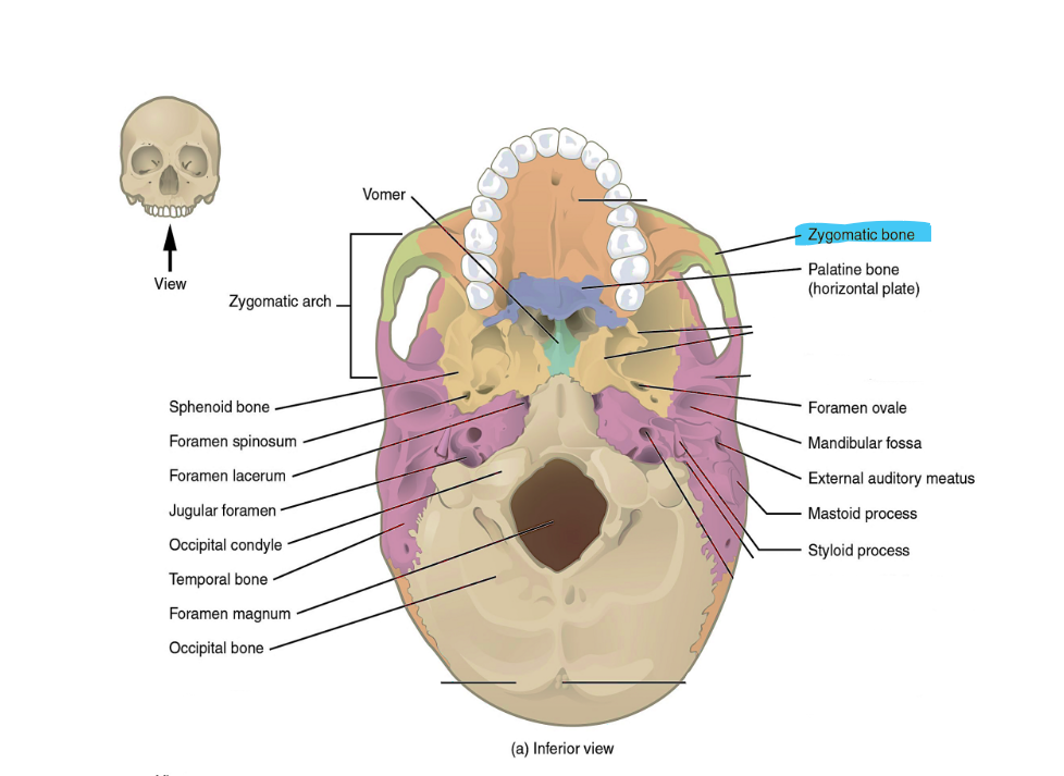 <p>zygomatic bone</p>