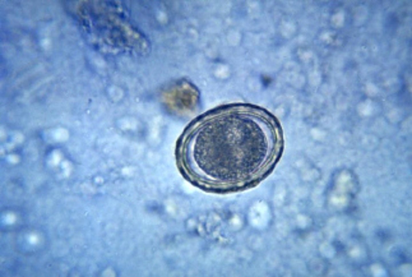 <p>a.Ascaris lumbricoides</p><p>The usual diagnostic stage is the egg. Fertile Ascaris eggs are oval, measure 45 to 75 μm by 35 to 50 μm, and have thick hyaline walls surrounding a one-cell-stage embryo. Most eggs have a brown, bile-stained mammillated outer layer, not seen in this image</p>