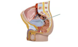 <p><span>Identify the highlighted structure</span></p>