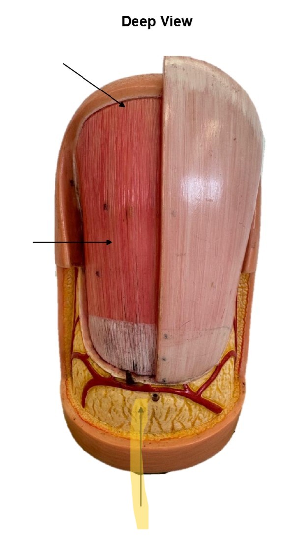 term image