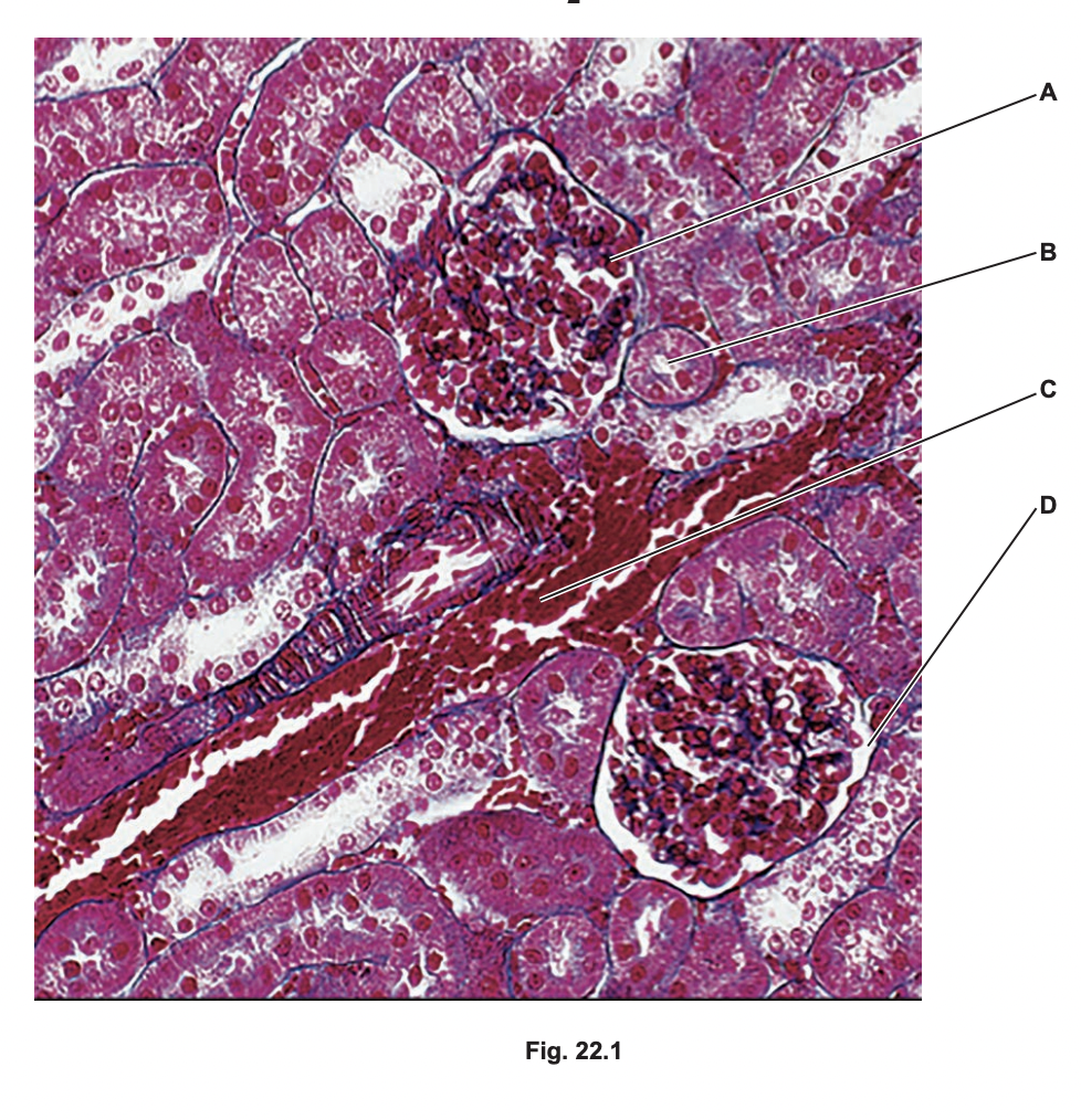Cross section of part of the cortex of a mammalian kidney

which letter identifies the region with the highest hydrostatic pressure

which two letters identify regions that do not contain plasma proteins