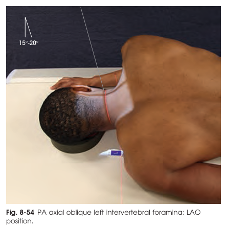 <p>How should the patient's body and cervical spine be positioned relative to the IR for PA axial oblique projection of the cervical intervertebral foramina?</p>