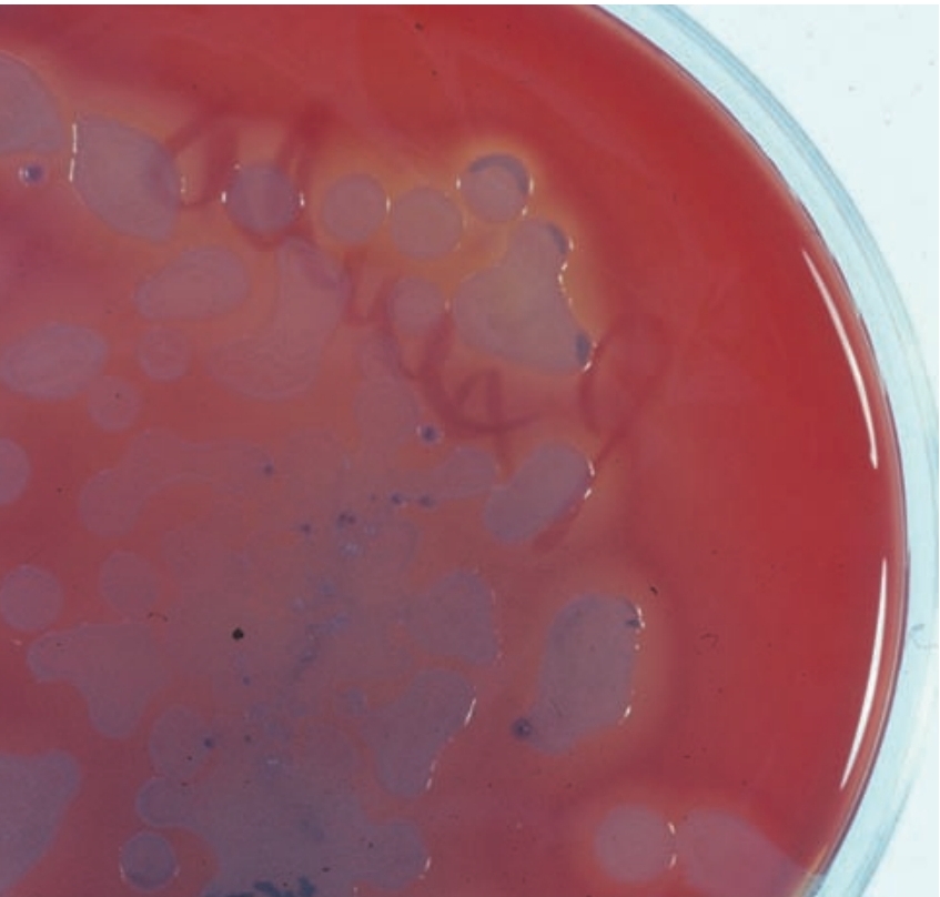 <p>Green gray colonies w/ hemolysis</p>