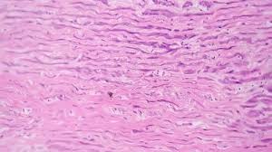 <p>What tissue is this</p>