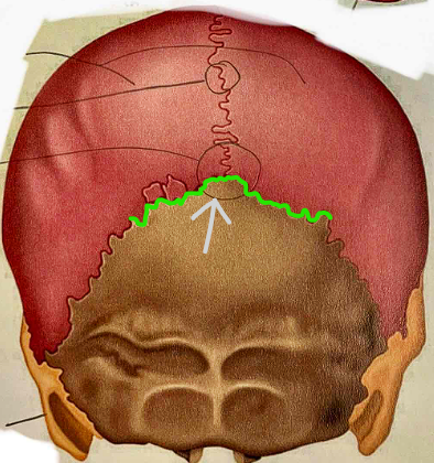 <p>What suture is this?</p>