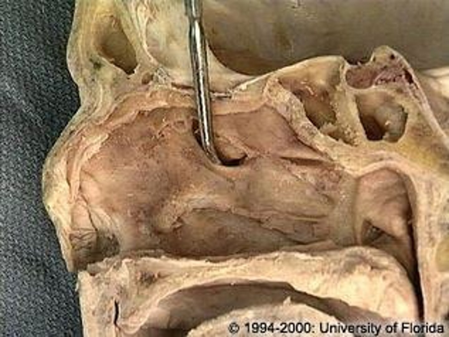 <p>opening separating middle meatus and infundibulum</p>