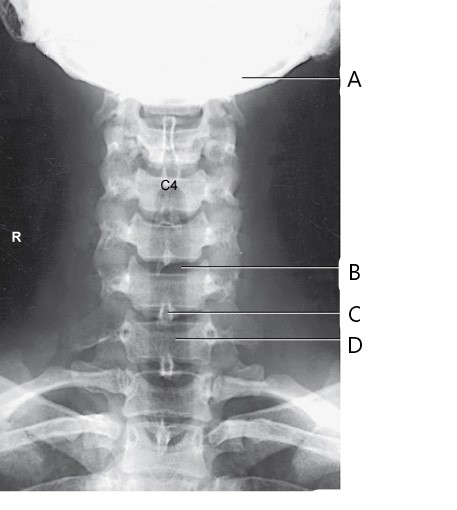 <p><span>The structure labeled B in the image above is</span></p>