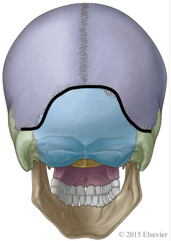 <p>which suture is highlighted here</p>