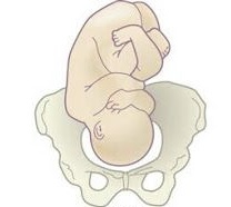 <p>What fetal position is this?</p><p>Assuming: R|L</p>