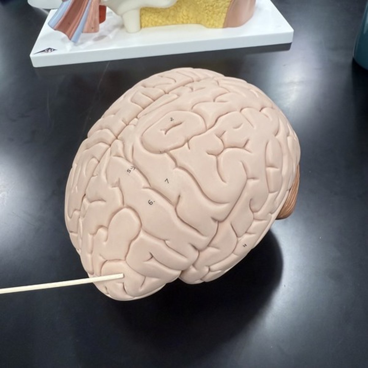 <p>What is this lobe of the cerebrum?</p>