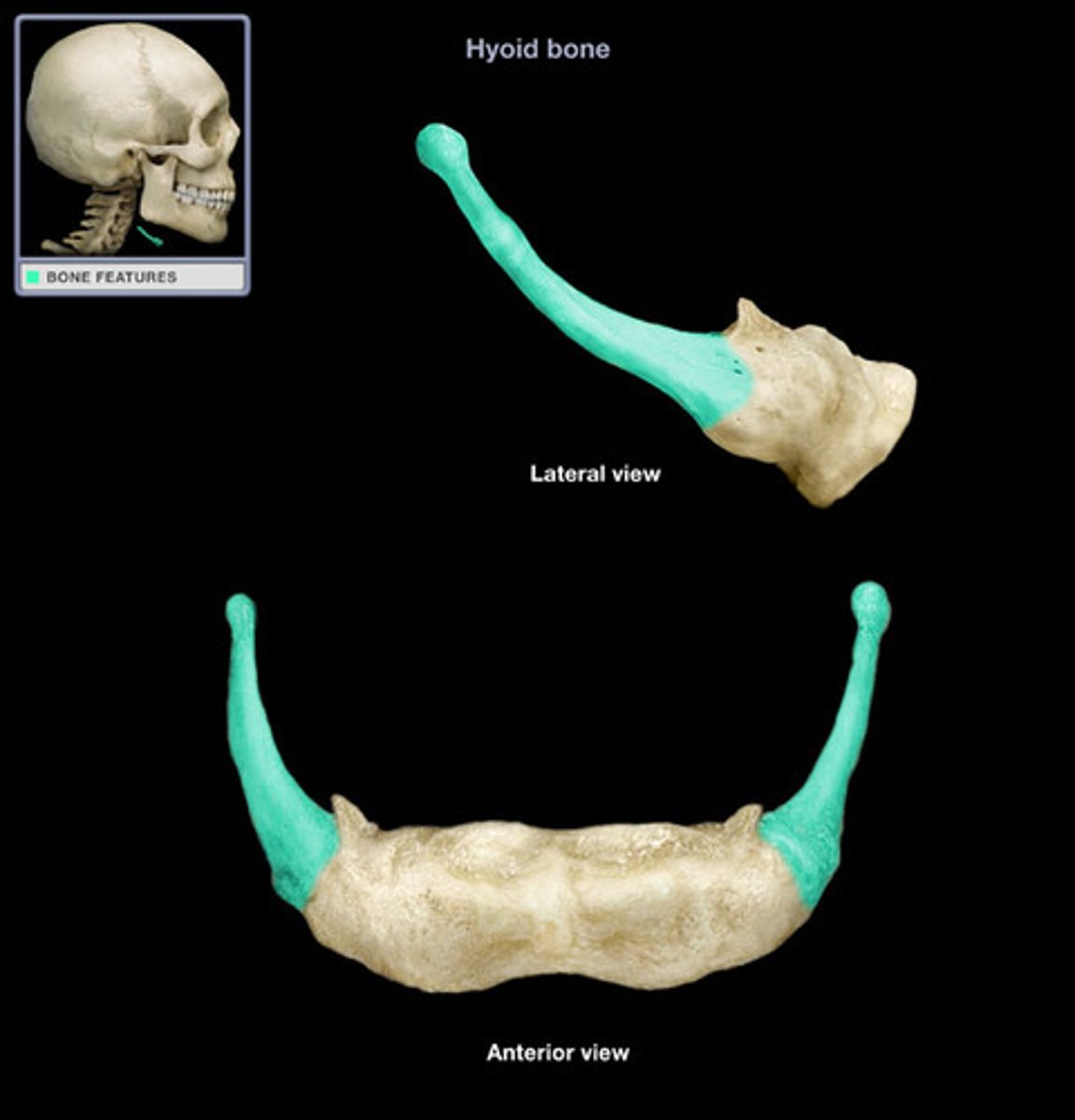 <p>Name the Specific Part of the Hyoid</p>