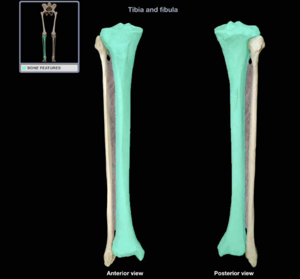 <p>Tibia </p>