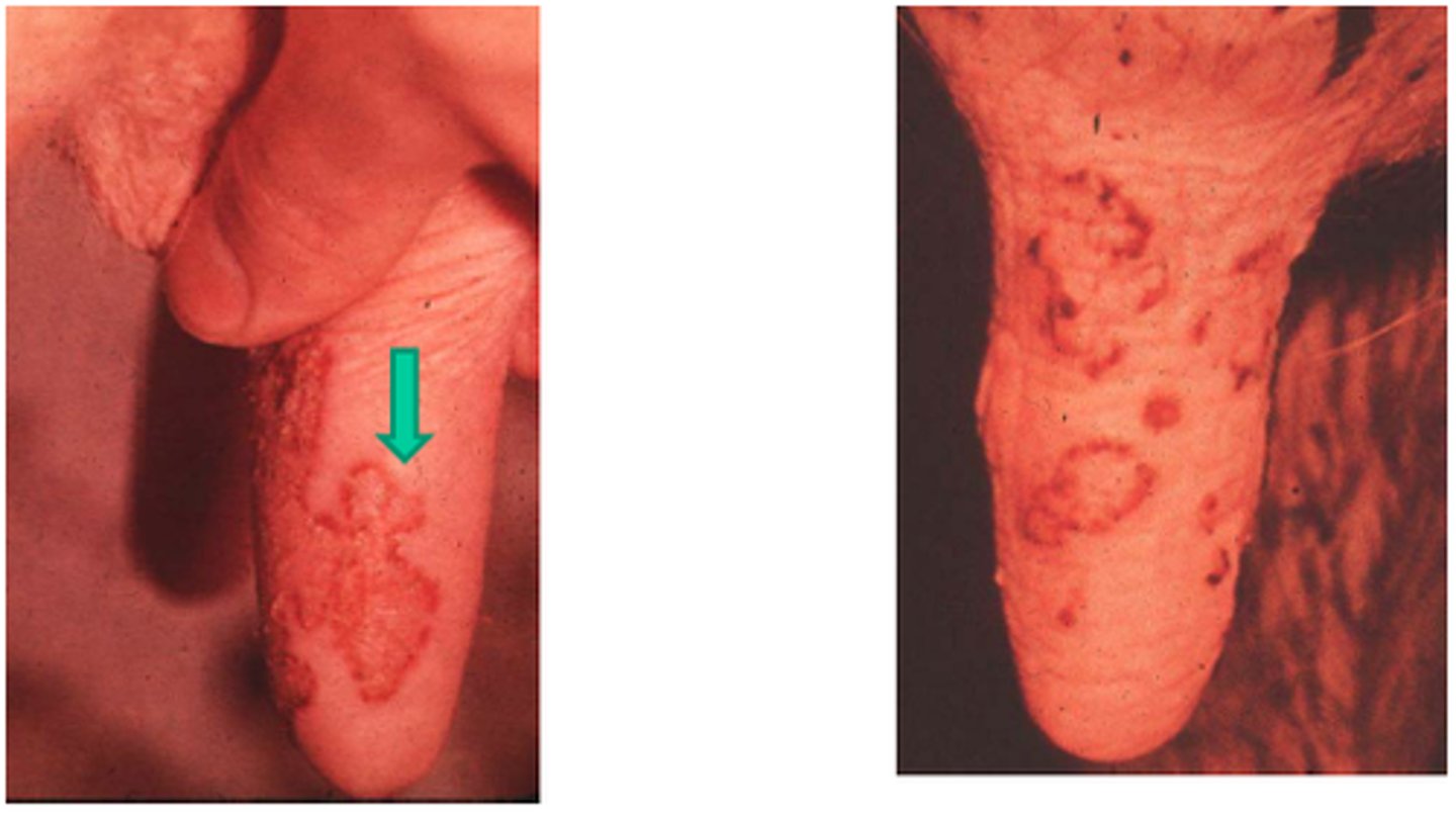 <p>A cow presents with these teat lesions. They are crusting, scabbing, papules. What should you do to treat?</p>
