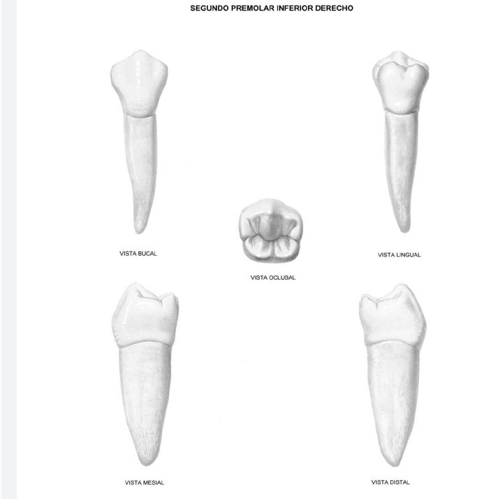 <p>What is this tooth ?</p>