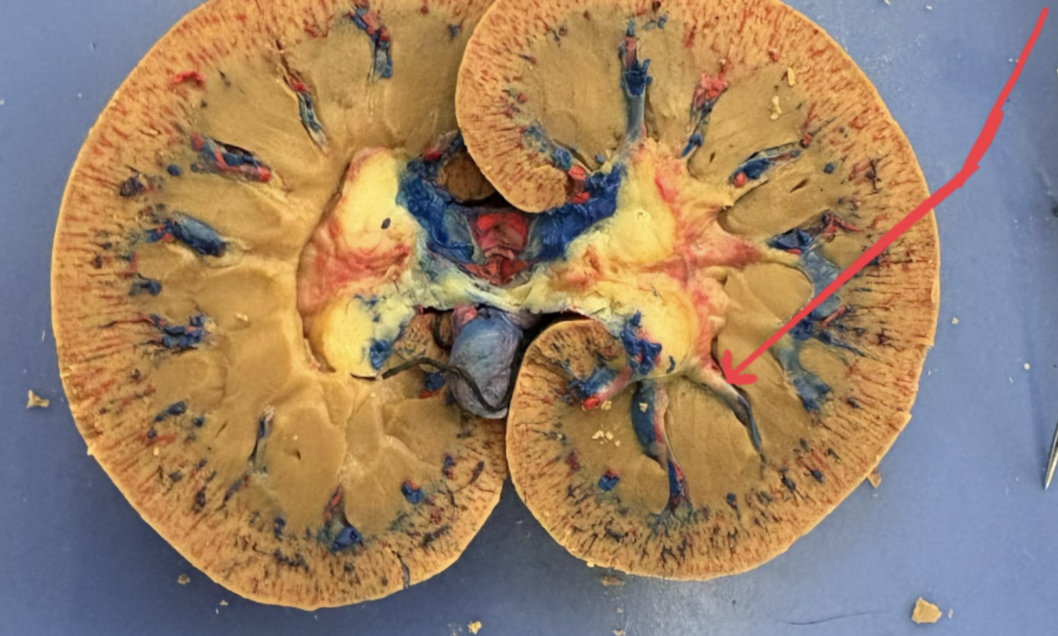 knowt flashcard image