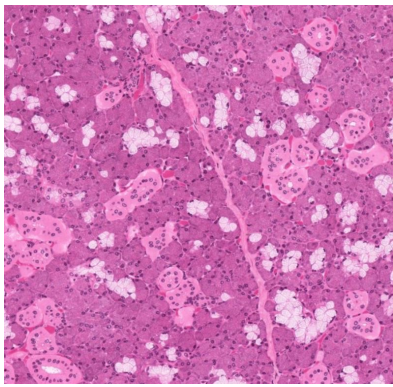 <p>what gland is this</p>