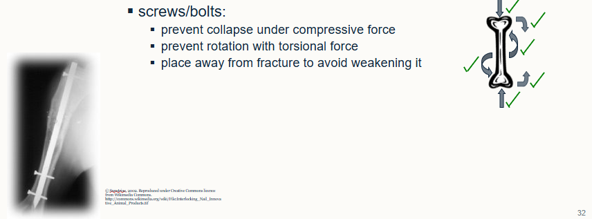 <ul><li><p>resist all 3 forces</p></li><li><p>central nail resists bending</p></li></ul><p>screws/bolts:</p><ul><li><p>prevent collapse under compressive force</p></li><li><p>prevent rotation with torsional force</p></li><li><p>place away from fracture to avoid weakening it</p></li></ul><p></p>