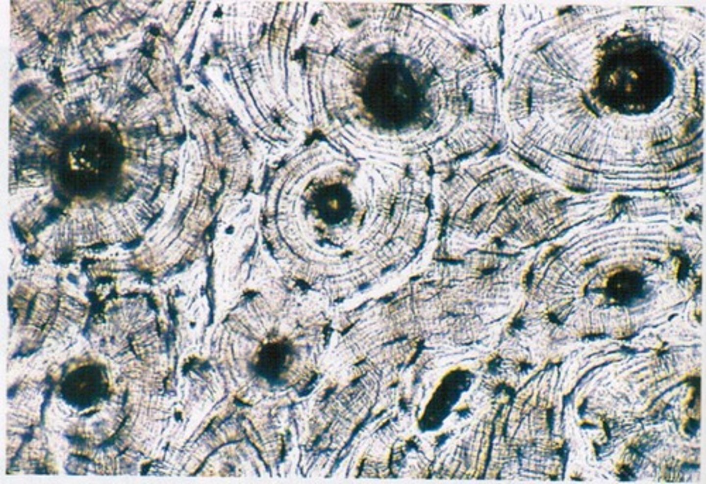 <p>Very vascular osteocytes in lacunae. Hard calcified matrix with collagen.</p>