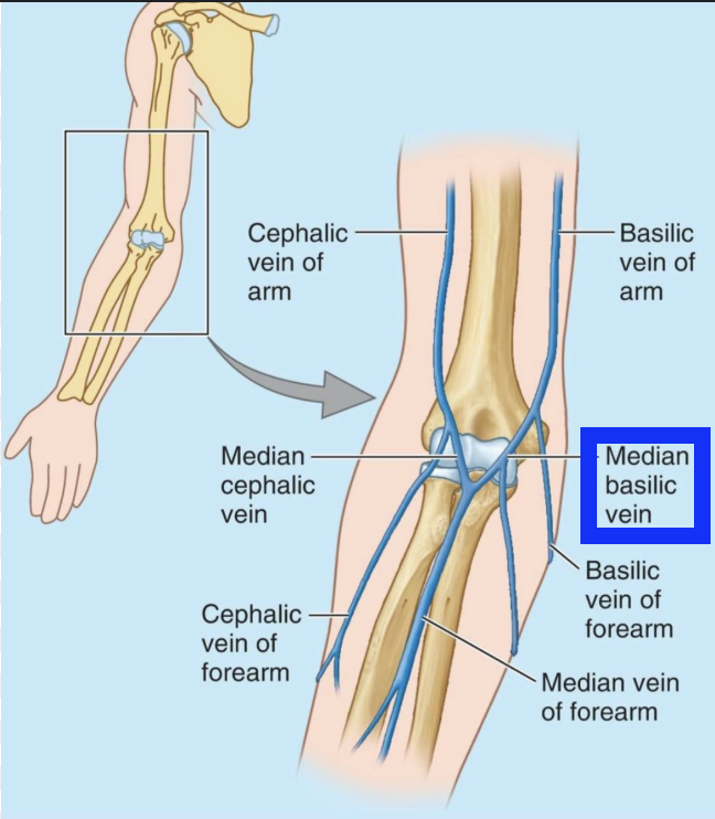 <p>right arm</p>