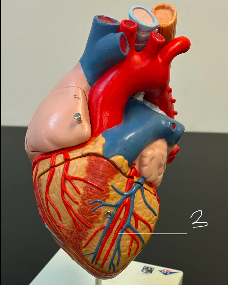 <p>Anterior interventricular artery</p>