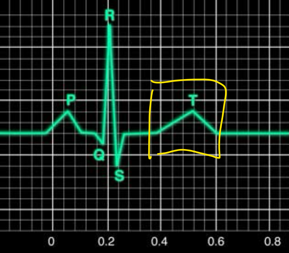 <p>Ventricular repolarisation</p><ul><li><p>ventricles will relax soon</p></li></ul>