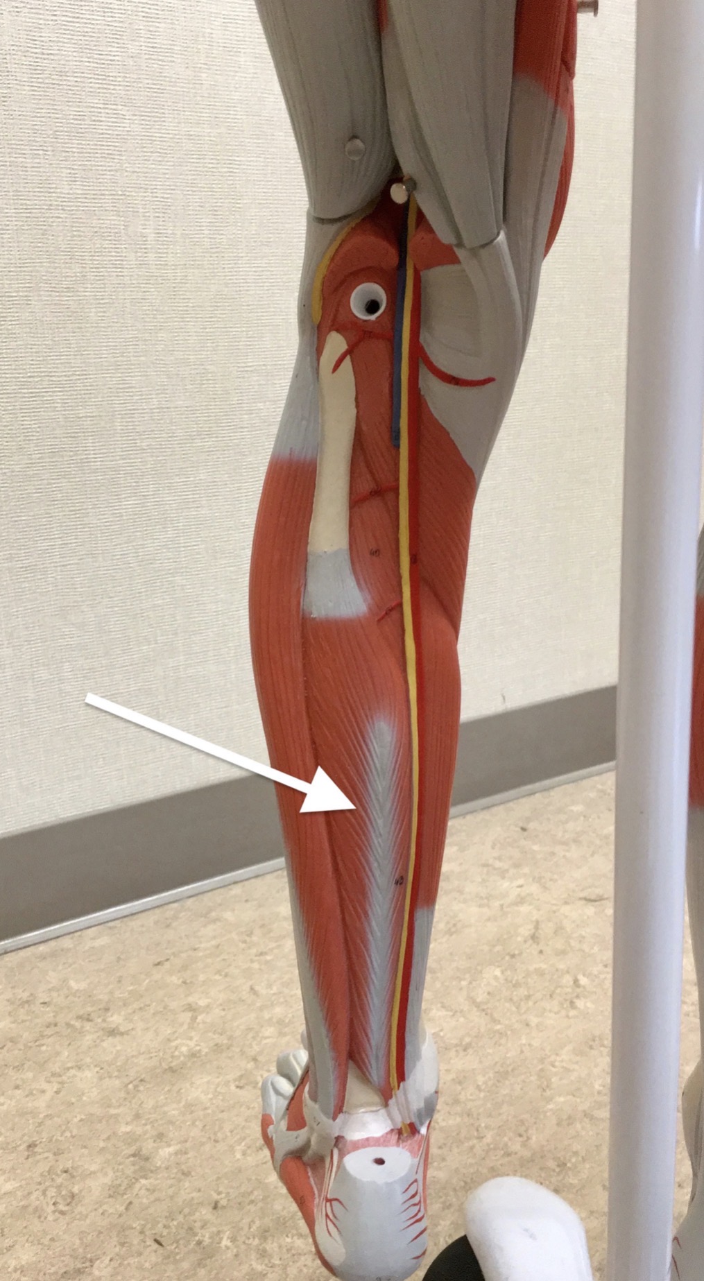 <p><span>Name the muscle labeled with the white arrow below:</span></p>