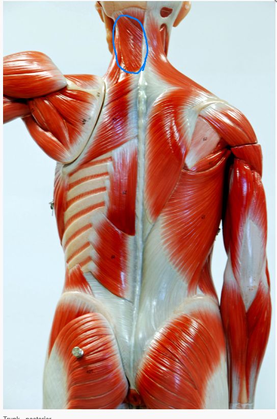 <p>What is the Muscle Circled?</p>