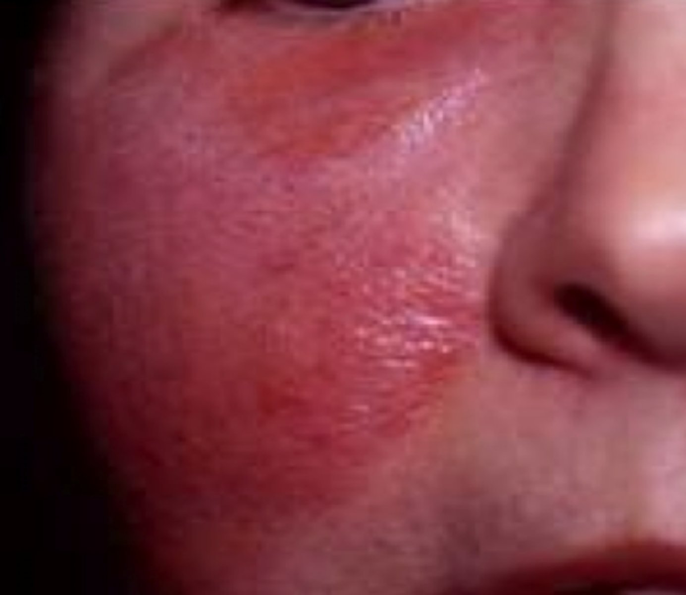 <p>What is the diagnosis?</p>