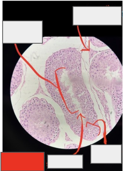 <p>What organ is this?</p>