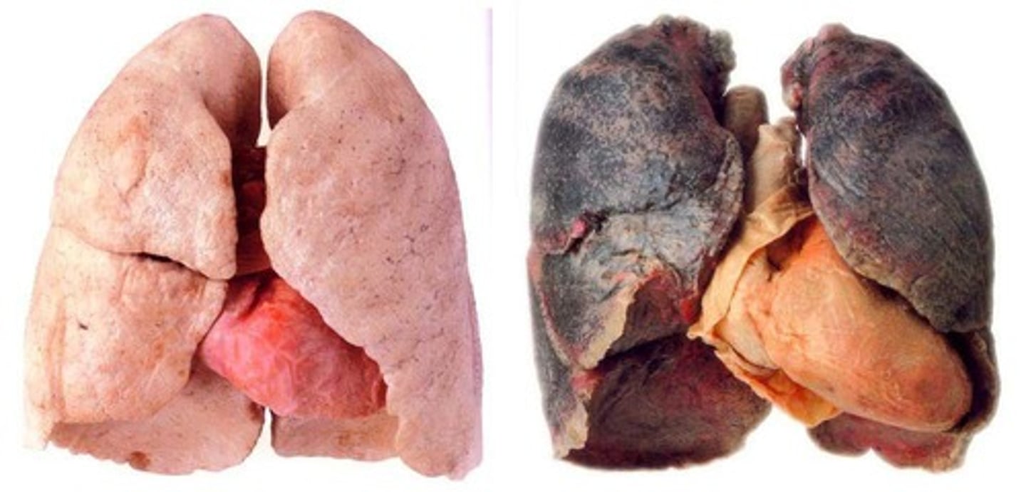 <p>lungs on the right</p>