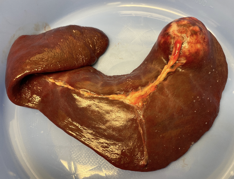 <p>True, regardless of pathology, splenectomy is indicated. Do not venture a&nbsp;“guess” on pathology to owner&nbsp;</p>