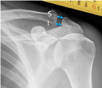 <p>Q what is the name of this measurement? and what is the average + range?</p>