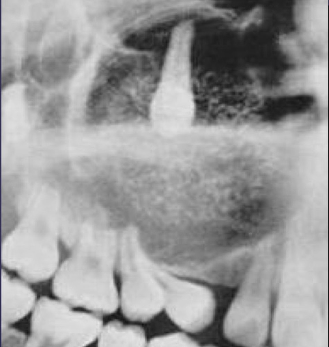 <p>What category would you put this lesion into?</p>