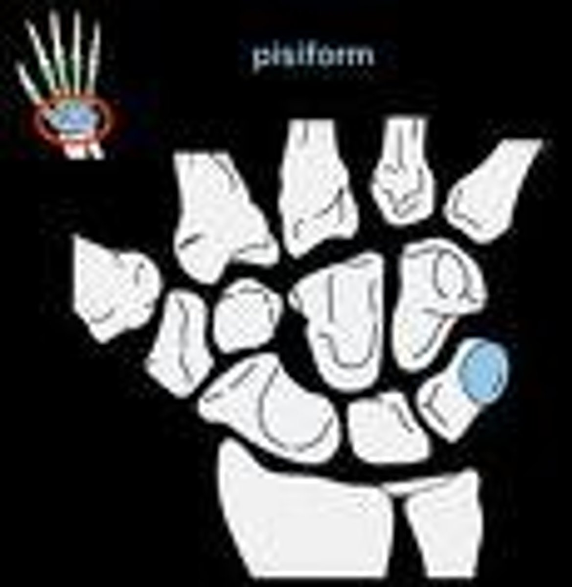 <p>- small knobbly, pea-shaped sesamoid bone that is found in the wrist</p><p>- forms the ulnar border of the carpal tunnel</p>