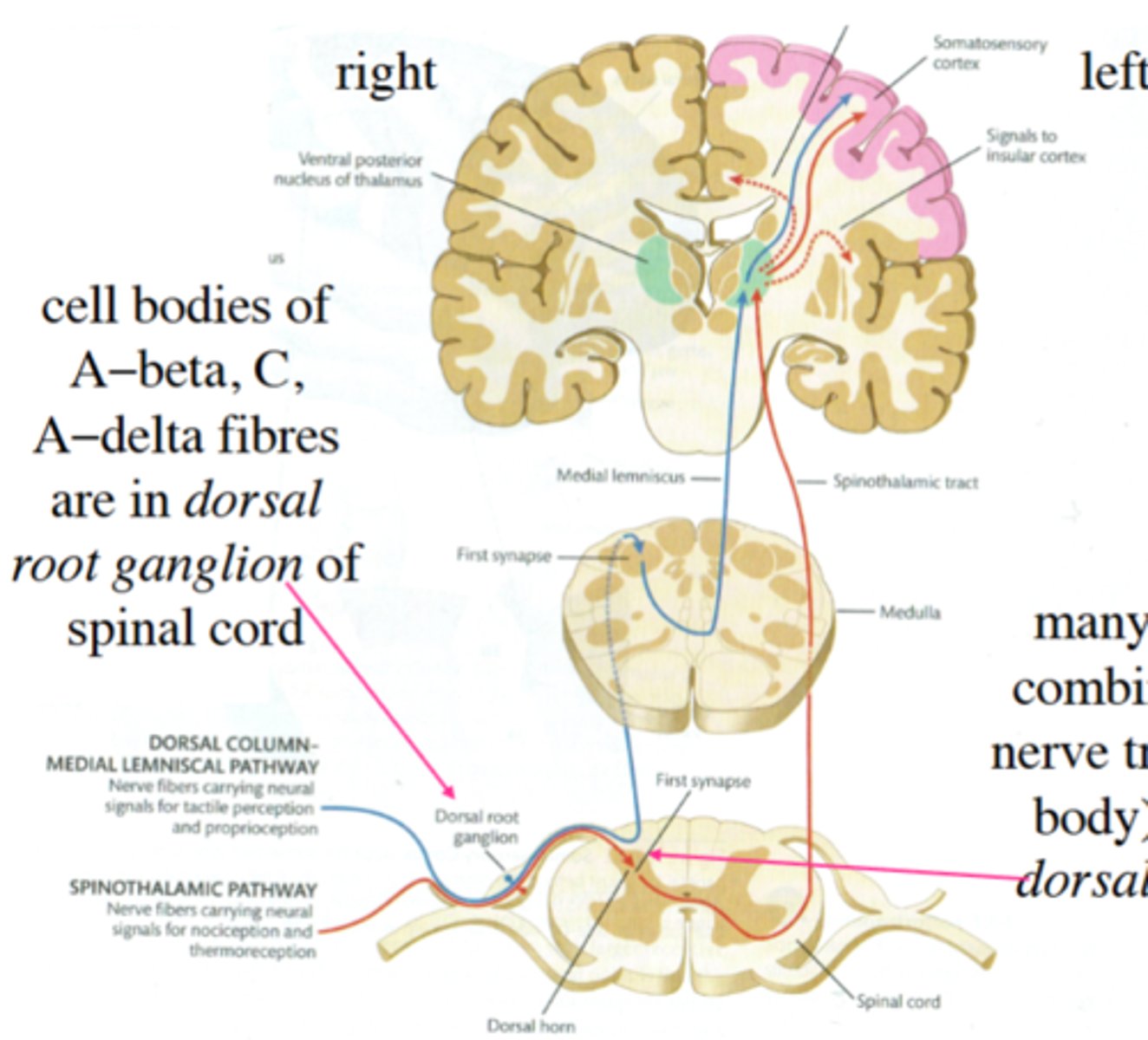 <p><b>Dorsal-column-medial-lemniscal pathway; pressure and position</b><br>1st synapse for most neurons in the medulla (some synapse in spinal chord)<br>Then up the dorsal column <br>2nd synapse at the thalamus in the ventral posterolateral nucleus <br>3rd synapse in parietal cortex of S1<br><b>Spinothalamic pathway; temp &amp; pain</b><br>1st synapse in substantia gelatinosa (layer 2) of dorsal horn in spinal cord.<br>Then through the medulla and up the lateral spinothalamic tract. <br>2nd synapse at the thalamus in the ventral posterior nucleus (VPL)<br>3rd synapse in parietal cortex of S1</p>