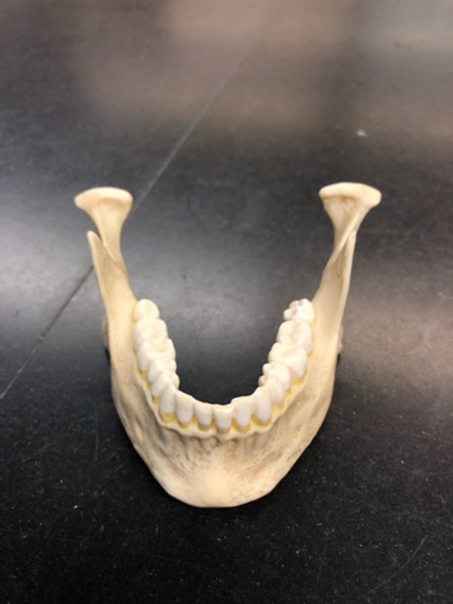 <p><b>Entire Structure</b><br><br>Jawbone</p>