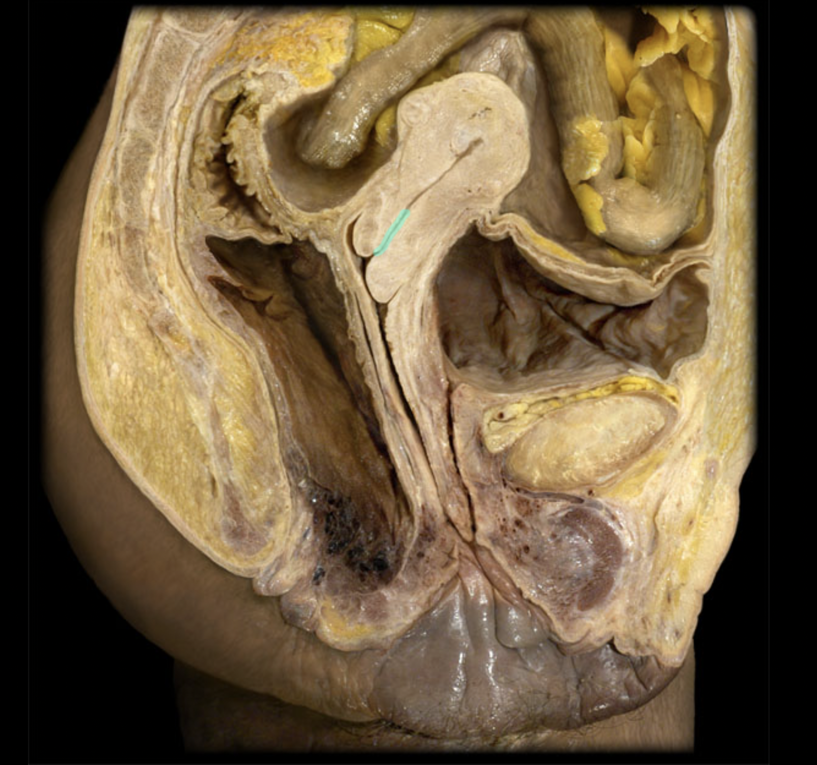 <p>What structure is shown?</p>