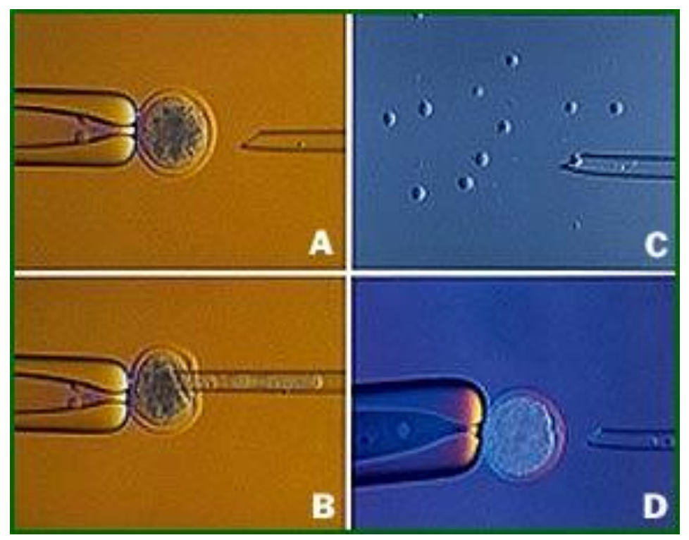 <p>SCNT (somatisk cellekjerne transplantasjon):</p><p></p><p>Trekker ut cellekjernen fra et egg, implanterer en cellekjerne i det denukulerte egget</p>