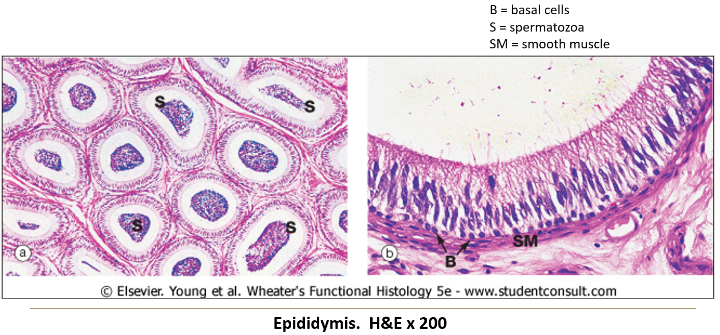 <p><strong>Tall pseudostratified epithelium with stereocilia</strong> (not motile, just for increased surface area).</p>
