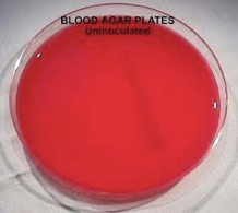 <p><span style="font-family: "Franklin Gothic Book";"><span>5% Sheep Blood Agar</span></span></p>