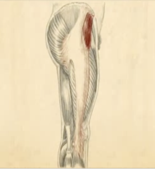 <p><span>Identify the distal end of the iliotibial band.</span></p>