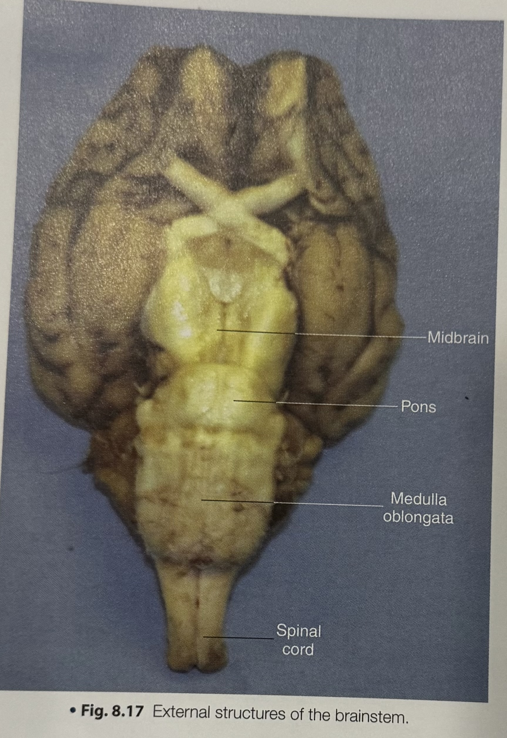<p>Brain Stem Structures</p>