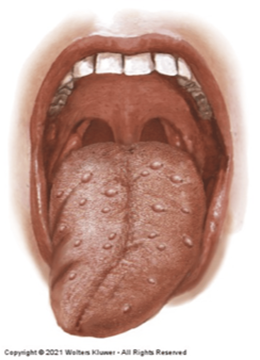 <p>Diagnosis?</p>