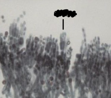 <p>What specific structure is being pointed at in the picture </p>