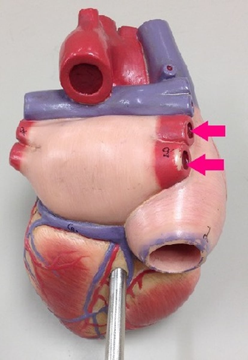 <p>Identify the vessels. Be specific.</p>