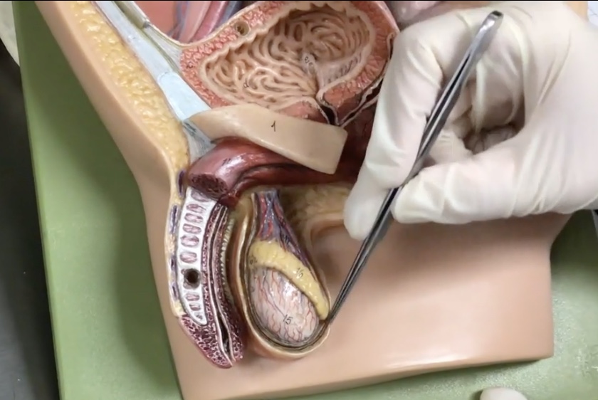 <p>Description: Structure on the superior surface of testis in scrotum</p><p>Relationship: N/A</p>