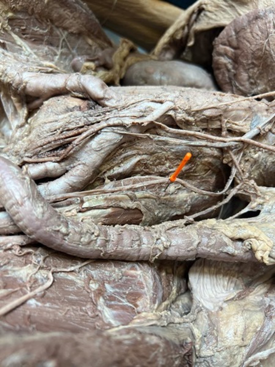 <p>inferior mesentereric vain</p>