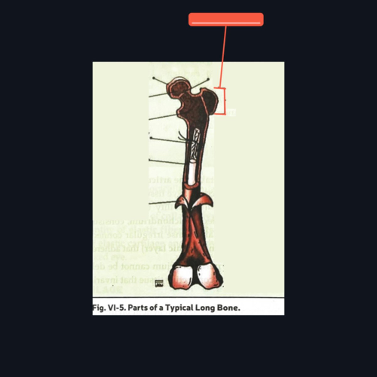 <p>Identify what part of a typical long bone is encompassed by the bracket symbol. What type of cartilage is it made up of?</p>