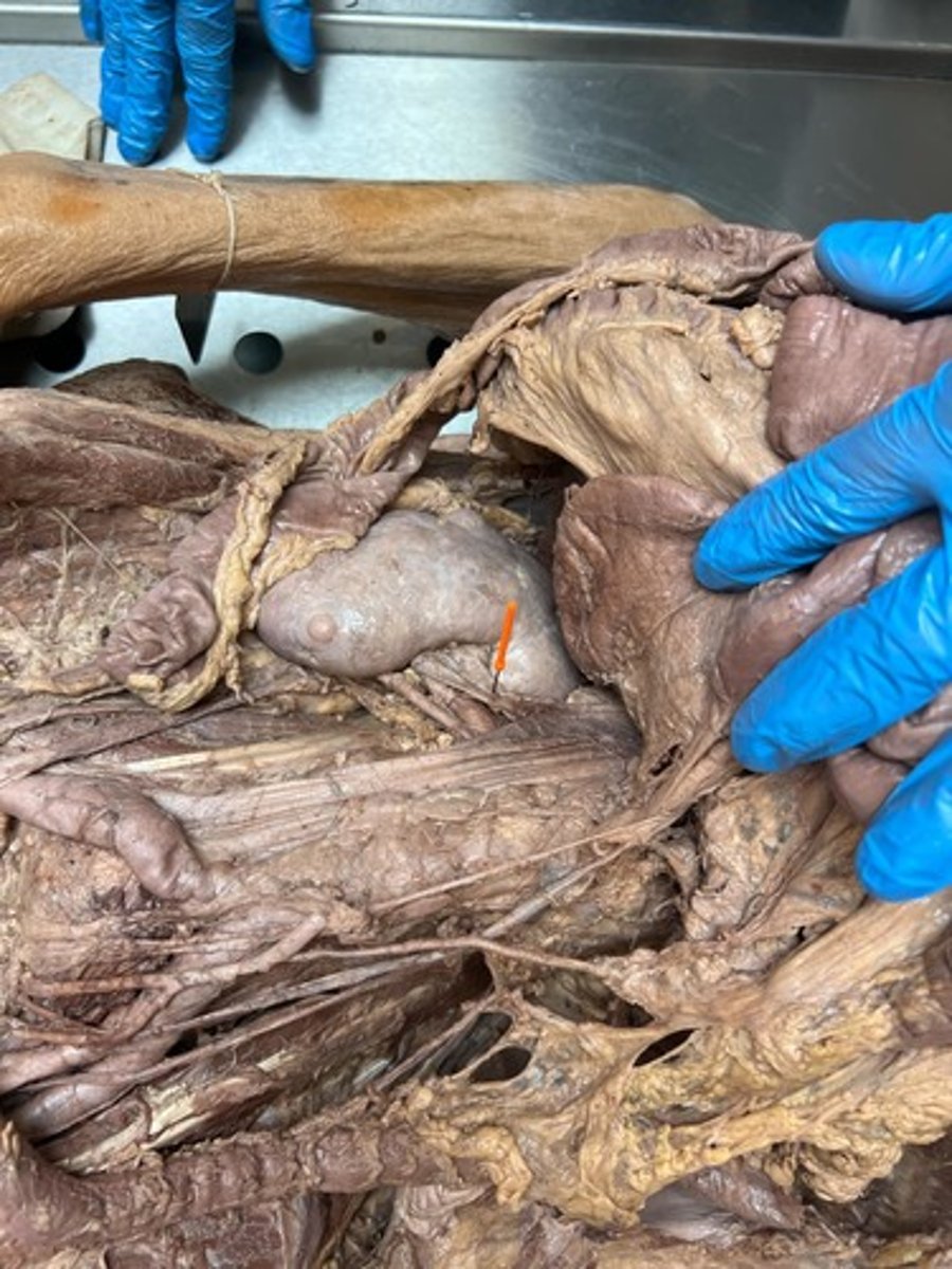 <p>l-r renal vain</p>